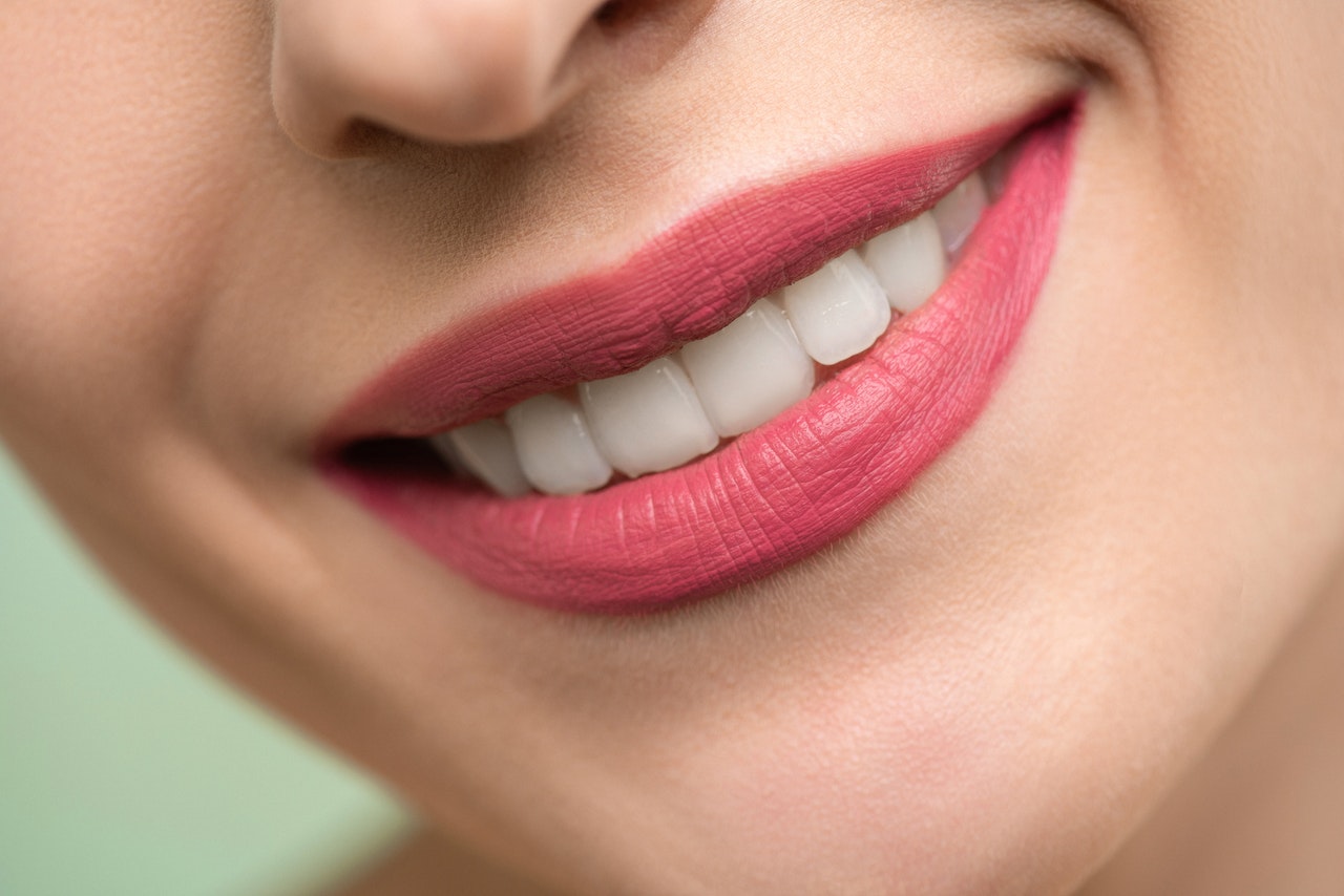 Coisas a saber antes de fazer o clareamento dos dentes (Foto de Shiny Diamond no Pexels)
